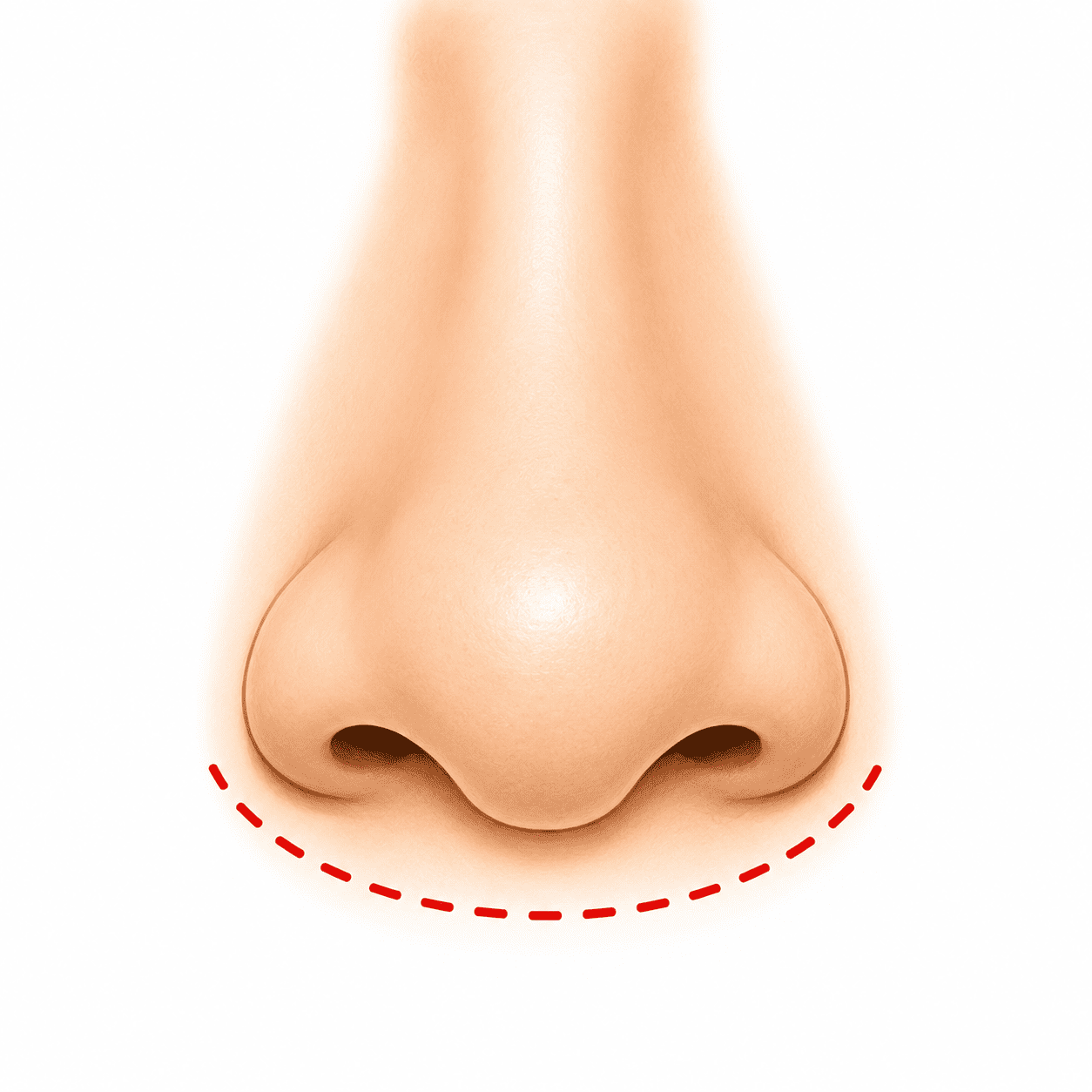 Bulbous nose concern illustration